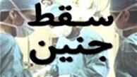 شرایط صدور مجوز سقط 