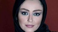تغییر چهره «شقایق فراهانی» /عکس