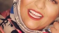 رابعه اسکویی جوانتر از قبل+عکس