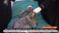افزایش آمار شهدای جشن عروسی در یمن به ۲۵ تن