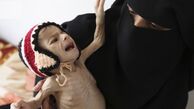 سایه شوم وبا؛ جان ۱۳ میلیون یمنی در خطر است 