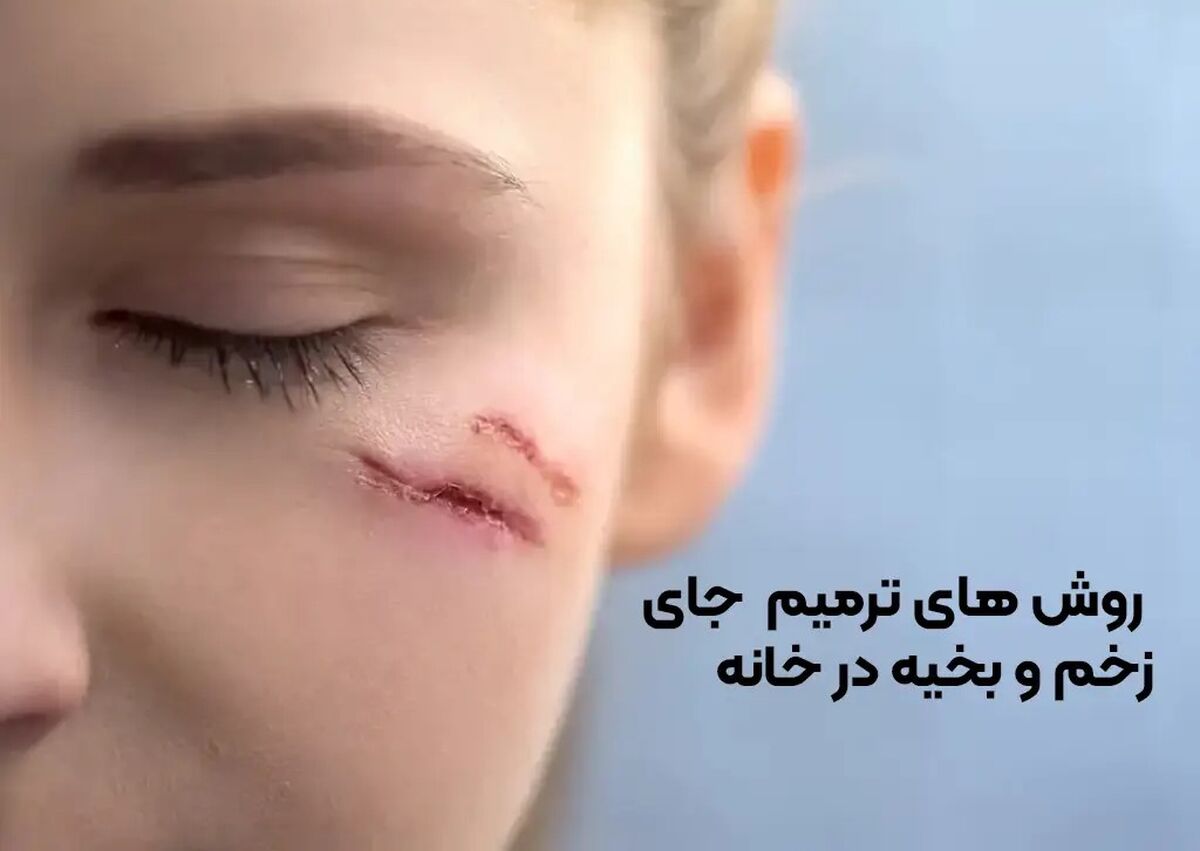 ۹ روش ترمیم جای زخم و بخیه در خانه