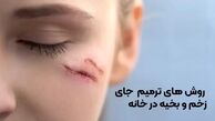 ۹ روش ترمیم جای زخم و بخیه در خانه