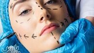 جراحی زیبایی؛ انواع، خطرات، نکاتی که باید در نظر بگیرید