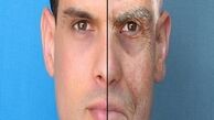 رژیم لاغری سخت، پوست را شل می‌کند