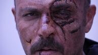 وقتی چشم بازیگر شاه کش کنده میشود+عکس