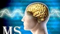 همه چیز در مورد ام اس