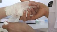 چگونه تاول ناشی از سوختگی را در کمترین زمان درمان کنیم؟