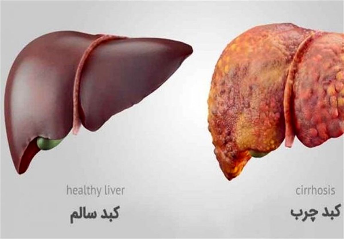 4 نوشیدنی مفید برای سم‌زدایی از کبد