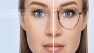 4 نکته طلایی قبل از عمل های لیزری چشم