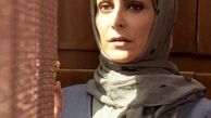 صورت آفتاب خورده خانم بازیگر + عکس