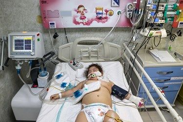 تصاویری دلخراش و دردناک از کودکان کرونایی