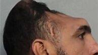 این مرد با سر نصفه زندگی می کند + تصاویر