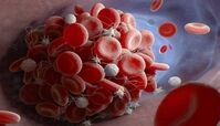 احتمال آسیب به سلول‌های جداره رگ‌ها در مبتلایان به کرونا