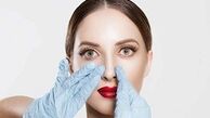 همه چیز درباره جراحی بینی