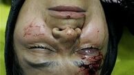 تعداد مجروحان چهارشنبه پایان سال کشور به ۱۴۸ نفر افزایش یافت