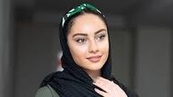صورت پُر از لَک «ترلان پروانه» /عکی