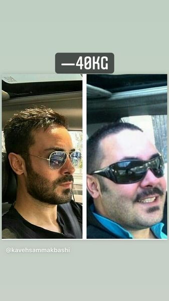 کاهش وزن چهل کیلویی بازیگر جوان + عکس