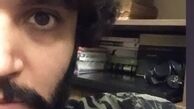 صورت نصفه و‌نیمه‌ آقای بازیگر + عکس