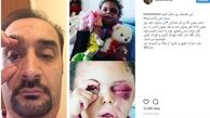 ابراز همدردی  مجری معروف با کودک یمنی + عکس