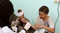43 هزار نفر در یمن کشته و زخمی شده‌اند