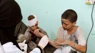 43 هزار نفر در یمن کشته و زخمی شده‌اند