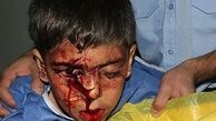 توصیه‌هایی برای حفظ سلامت چشم در چهارشنبه سوری 